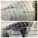 chest xray small.jpg